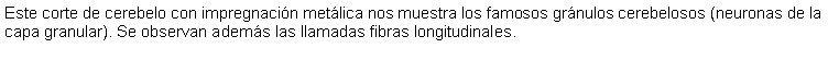 Cuadro de texto: Este corte de cerebelo con impregnacin metlica nos muestra los famosos grnulos cerebelosos (neuronas de la capa granular). Se observan adems las llamadas fibras longitudinales.