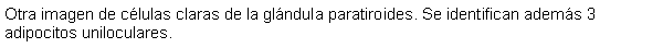 Cuadro de texto: Otra imagen de clulas claras de la glndula paratiroides. Se identifican adems 3 adipocitos uniloculares.